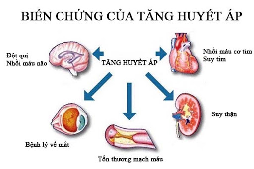 4 biểu hiện vào buổi sáng báo hiệu bạn bị cao huyết áp, đặc biệt dấu hiệu đầu tiên dễ gặp, dễ biết nhất nhưng hay bị bỏ qua nhất - Ảnh 2.