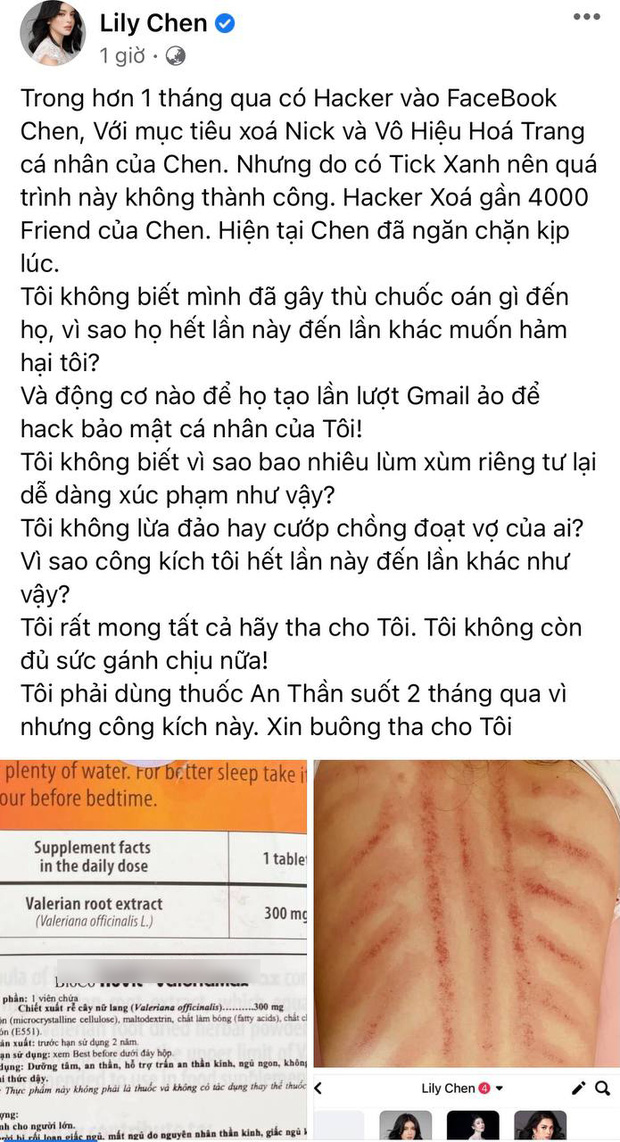 Sau ồn ào chung bồ với Ngọc Trinh, Lily Chen bỗng đăng ảnh lưng rướm máu, tiết lộ dùng thuốc an thần suốt 2 tháng qua - Ảnh 1.