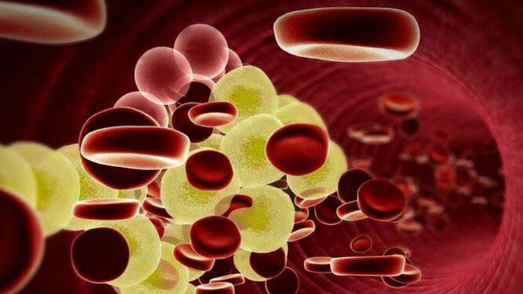 Cảnh báo nguy hiểm do tăng lipid máu và giải pháp thảo dược giúp hạ mỡ máu hiệu quả! - Ảnh 1.
