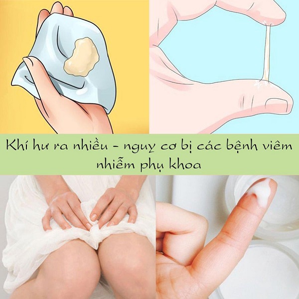 Sai lầm cần tránh khi chăm sóc  vùng tam giác vàng để ngừa ung thư cổ tử cung - Ảnh 4.