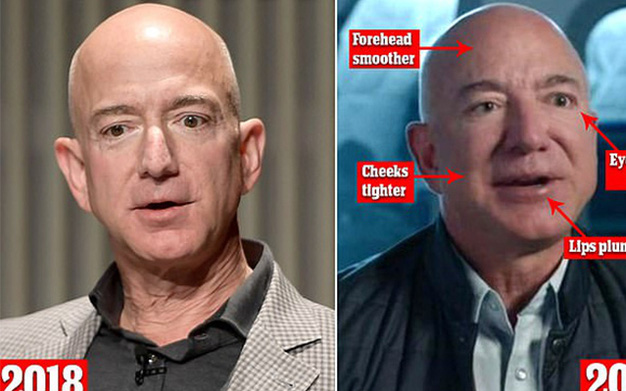 Tỷ phú Jeff Bezos bị nghi phẫu thuật thẩm mỹ