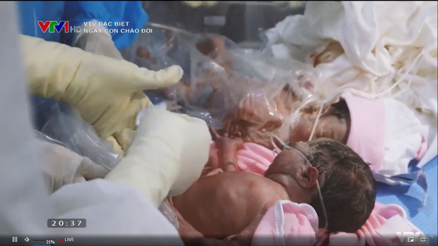 Phóng sự đặc biệt VTV Ngày con chào đời - giọt nước mắt hạnh phúc đón những sinh linh giữa đại dịch - Ảnh 3.
