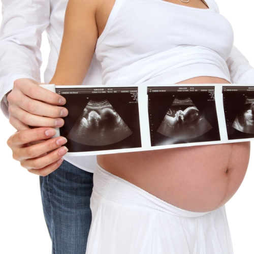 3 thời điểm siêu âm quan trọng thai phụ cần nhớ - Ảnh 2.