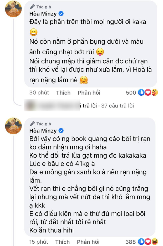 Cận cảnh chiếc bụng bầu đầy vết rạn thâm đen của Hòa Minzy, chỉ những ai làm mẹ mới hiểu hết loạt ảnh khó tin này! - Ảnh 7.