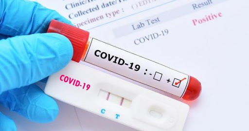 Bộ Y tế đề nghị tăng cường kiểm soát giá dịch vụ chẩn đoán COVID-19 - Ảnh 1.