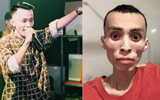 Nam rapper Việt qua đời vì bệnh ung thư ở tuổi 27: Cảnh báo loại ung thư nguy hiểm ai cũng có thể mắc, dấu hiệu bệnh dễ nhầm lẫn với &quot;bệnh vặt&quot; - Ảnh 1.