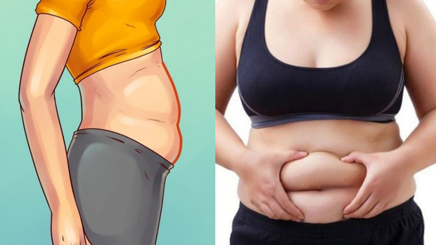 Có 3 kiểu béo bụng không phải do thừa cân, béo phì mà là ngầm cảnh báo một vài căn bệnh khác - Ảnh 2.