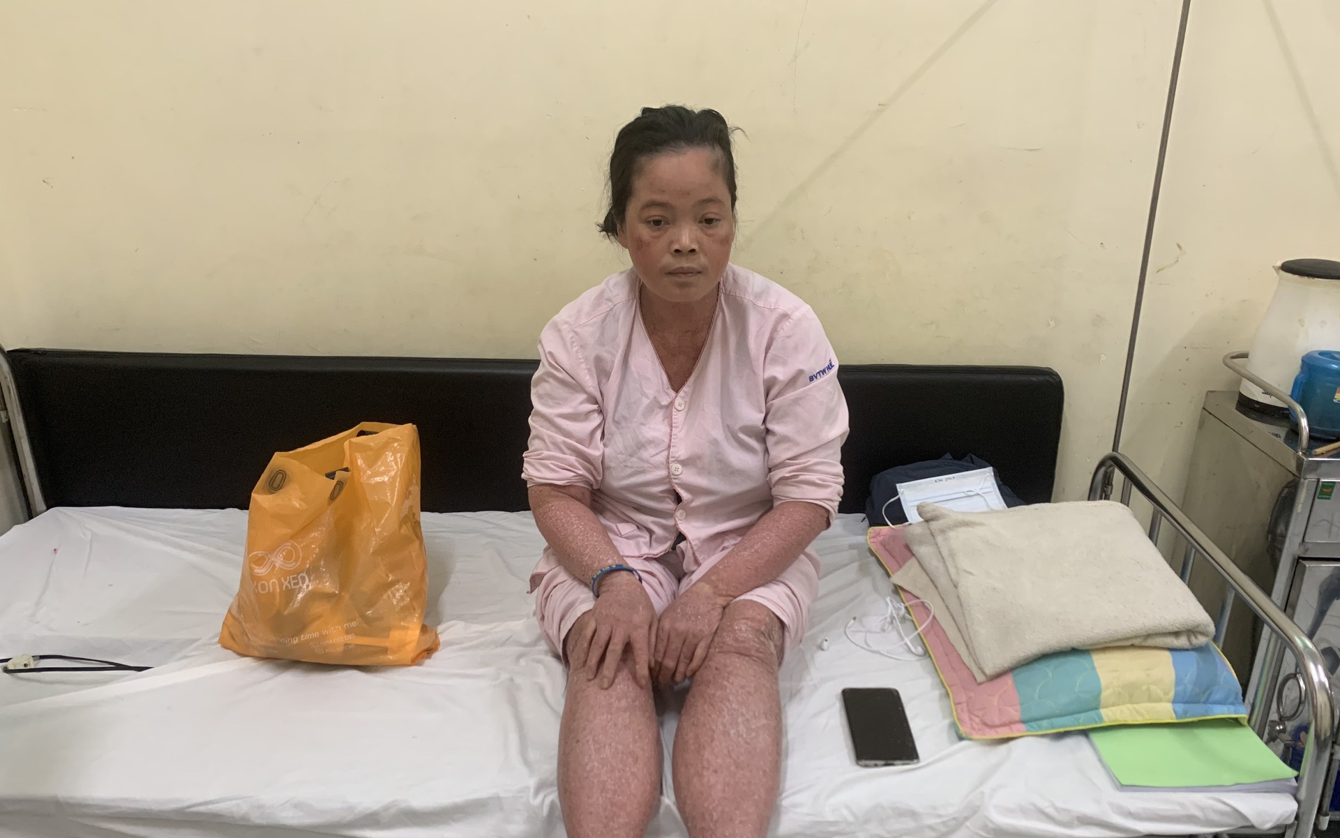 MS 796: Xót thương người phụ nữ sống neo đơn, mang trong mình căn bệnh hiếm gặp, không có tiền chữa trị