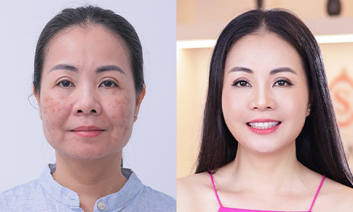Saigon Smile Spa - Hội tụ đa công nghệ làm đẹp đỉnh cao dẫn đầu xu hướng 2023 - Ảnh 3.