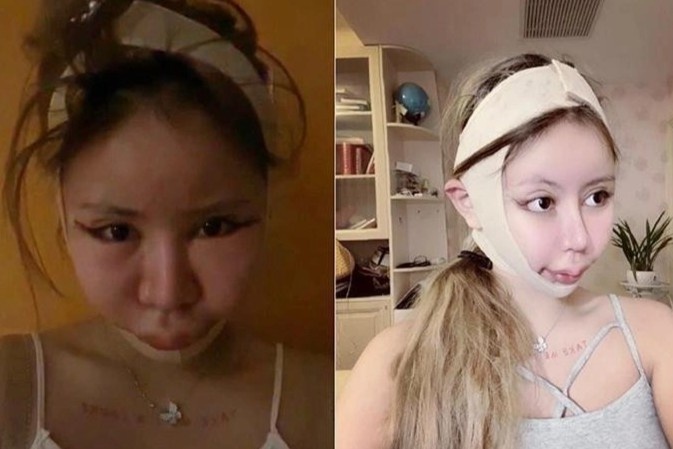 Người mẹ Nhật Bản ép con gái 9 tuổi cắt mí, làm mũi, nâng ngực - Ảnh 1.