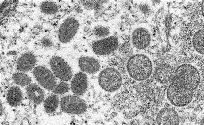 Chuyên gia bệnh truyền nhiễm: Bệnh đậu mùa khỉ không dễ lây lan, hoàn toàn có thể phòng ngừa - Ảnh 1.