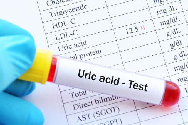 Làm gì khi khám sức khỏe thấy acid uric trong máu 'cao vọt'? - Ảnh 1.