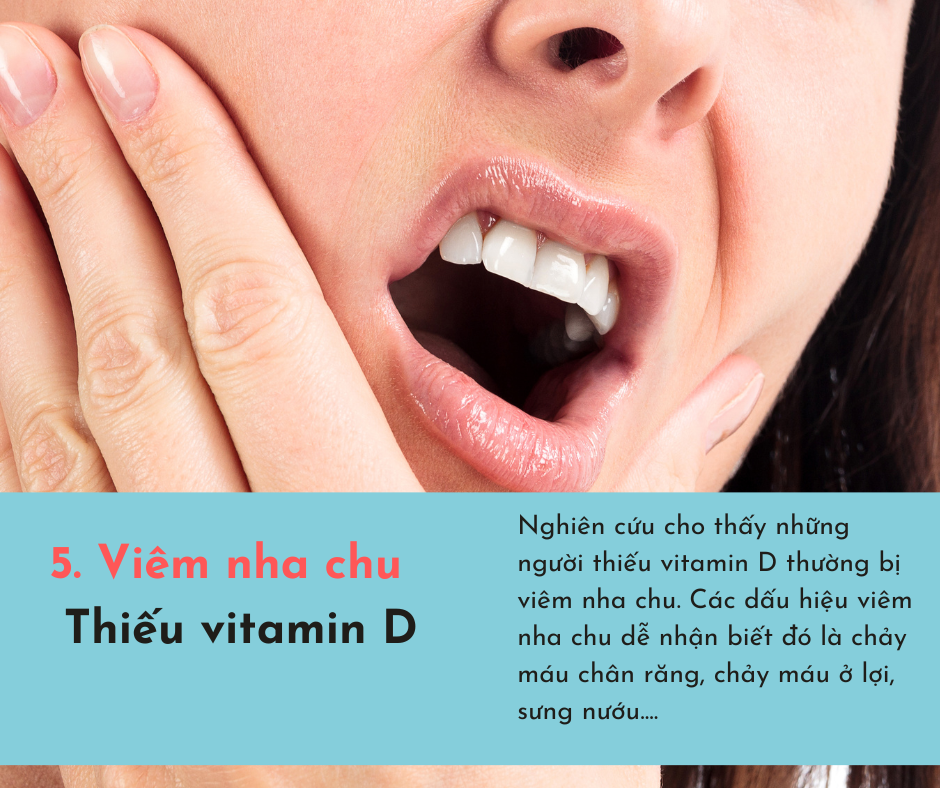Cơ thể bị &quot;cạn kiệt&quot; vitamin sẽ phát ra 6 dấu hiệu, chủ quan bỏ qua có thể sẽ tổn thọ  - Ảnh 5.