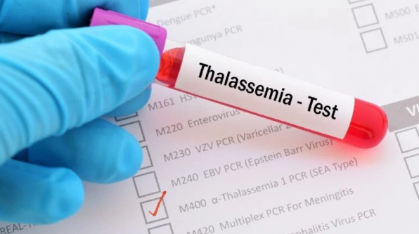 Người mang gene bệnh Thalassemia cần làm gì để sinh con khỏe mạnh? - Ảnh 2.