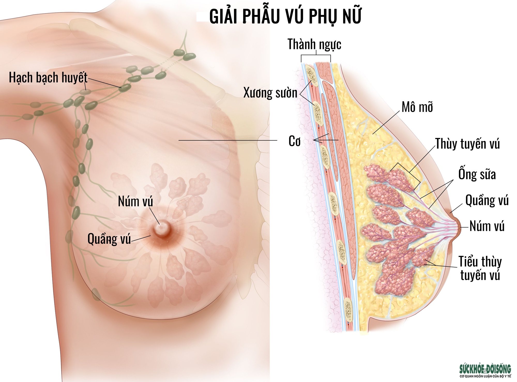 Ung thư vú: Các dấu hiệu nhận biết sớm - Ảnh 1.