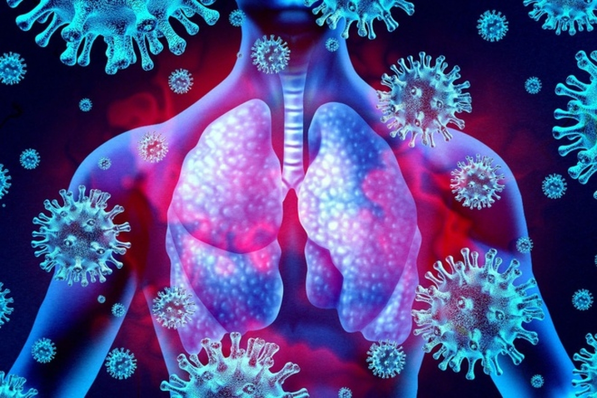 Vì sao người cao tuổi viêm phổi nhưng không có triệu chứng sốt? - Ảnh 1.