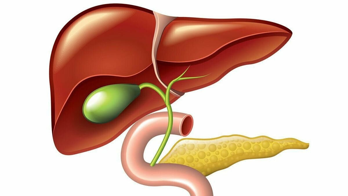 5 triệu chứng căn bệnh sỏi túi mật bạn cần chú ý - Ảnh 2.