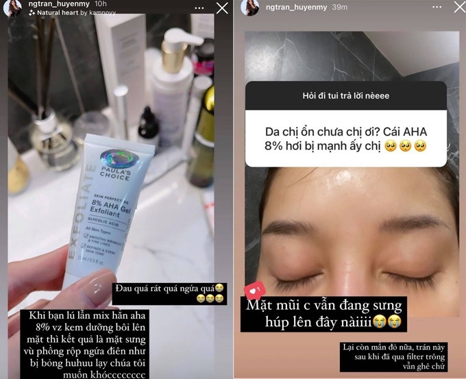 6 sao Việt từng bong da, mẩn đỏ khắp mặt vì skincare - Ảnh 5.