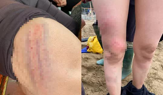 Vụ nh&oacute;m phụ nữ mặc &aacute;o ngực bị k&eacute;o l&ecirc;: Cố t&igrave;nh cản trở sẽ đề nghị khởi tố - Ảnh 2.