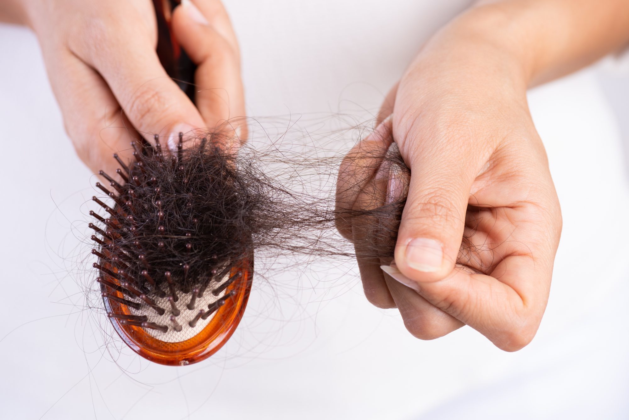 Bác sĩ tư vấn cách khắc phục rụng tóc hậu Covid-19 - Ảnh 1.