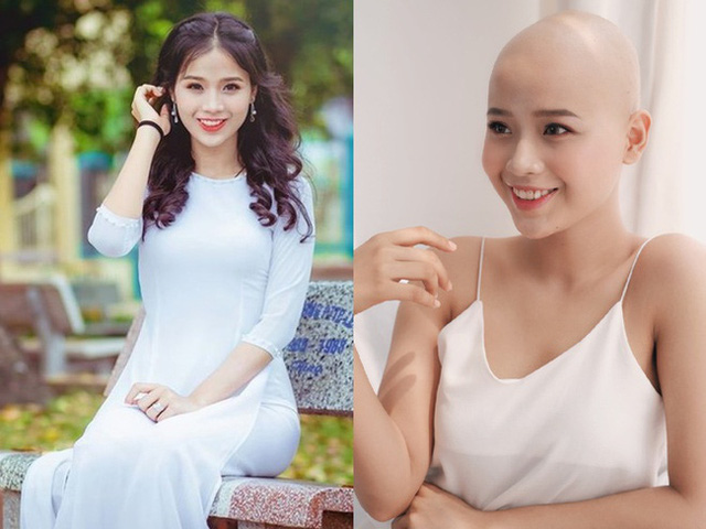 Người đẹp trọc đầu, chiến thắng ung thư đang 'gây bão' Miss World Vietnam 2022 là ai? - Ảnh 2.