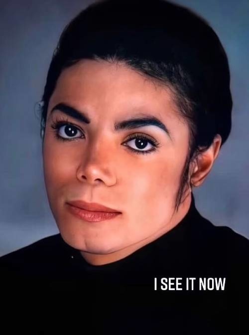 'Bản sao' Michael Jackson tuyên bố không phẫu thuật - Ảnh 3. 'Bản sao' Michael Jackson tuyên bố không phẫu thuật - Ảnh 3.
