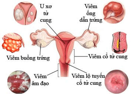 Làm thế nào để điều trị rối loạn chức năng tình dục ở phụ nữ? - Ảnh 2.