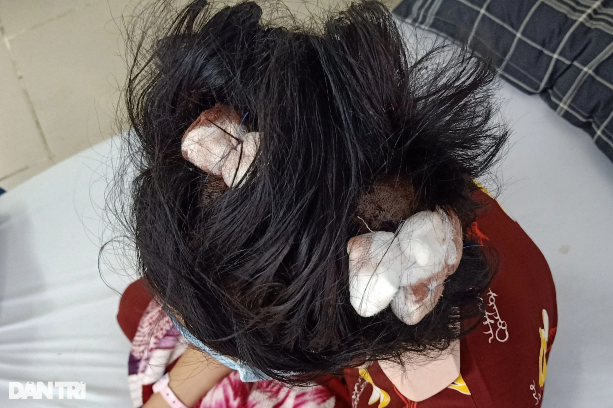 Bé gái 16 tuổi bị người tình của mẹ vụt gậy sắt đến bất tỉnh - Ảnh 1.