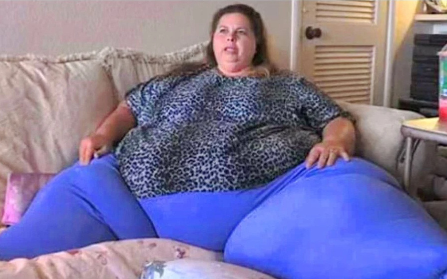 Người phụ nữ béo nhất hành tinh nặng 302kg chỉ có thể đi lại bằng xe đẩy “biến hình” sốc sau 10 năm, không nói không ai dám tin là 1 người