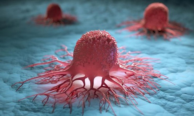 Khi tế bào ung thư lan rộng, cơ thể phát những tín hiệu này - Ảnh 1.
