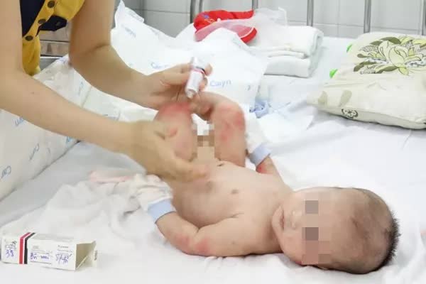 Căn bệnh khiến trẻ nhỏ sút cân, bỏ ăn, nhiễm trùng máu - Ảnh 2. Căn bệnh khiến trẻ nhỏ sút cân, bỏ ăn, nhiễm trùng máu - Ảnh 2.
