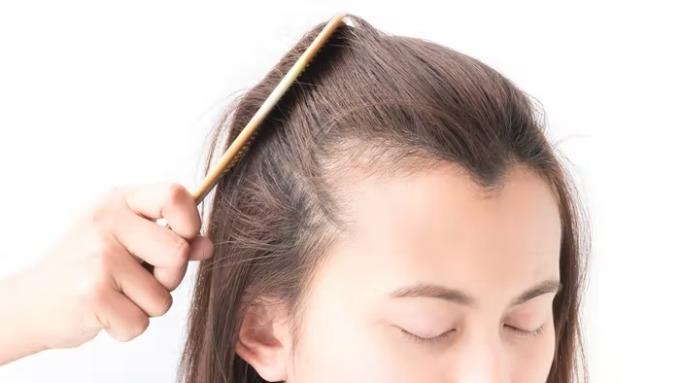 5 thói quen khiến tóc dưỡng mãi vẫn rụng lả tả - Ảnh 2.
