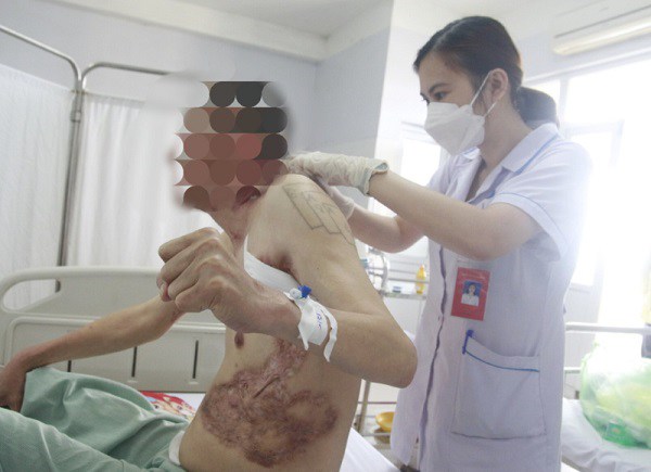 Quang Ninh man has sores and scars all over his body because sweat secretes rare pus - Photo 1.