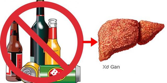 Người mắc bệnh viêm gan B nên kiêng gì? - Ảnh 5.