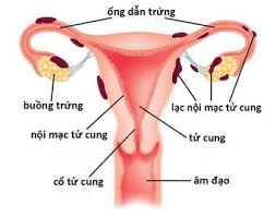 7 nguyên nhân chính dẫn đến vô sinh ở nữ - Ảnh 2.