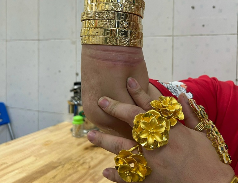 Chủ qu&aacute;n d&aacute;t v&agrave;ng cơ thể, trầy tay trộn ch&acirc;n g&agrave; vẫn kh&ocirc;ng th&aacute;o - Ảnh 5.