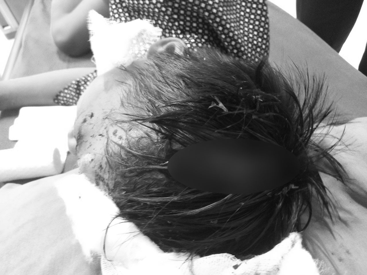 Bất ngờ bị chó tấn công, bé trai 8 tuổi hoảng loạn với nhiều vết thương trên người - Ảnh 1. Bất ngờ bị chó tấn công, bé trai 8 tuổi hoảng loạn với nhiều vết thương trên người - Ảnh 1.