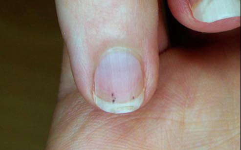 Nếu c&oacute; 9 triệu chứng c&oacute; thể tr&aacute;i tim của bạn đang "cầu cứu" - Ảnh 1.