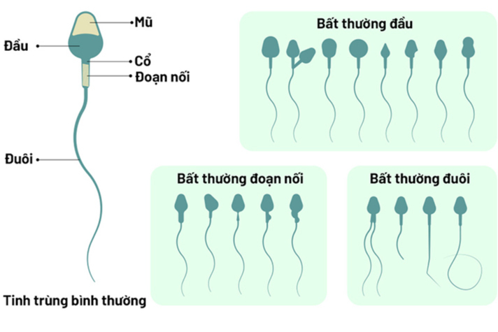 Hình thái tinh trùng ảnh hưởng đến khả năng sinh sản như thế nào? - Ảnh 4.