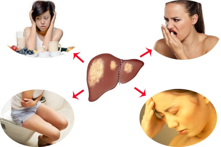 6 dấu hiệu cơ thể cảnh báo gan của bạn đang nhiễm độc, cần dừng ngay những  thói quen này và thải độc cho gan
