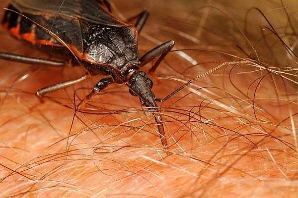 Cách nhận biết và sơ cứu khi bị 6 loại côn trùng nguy hiểm nhất vào mùa hè cắn - Ảnh 3.
