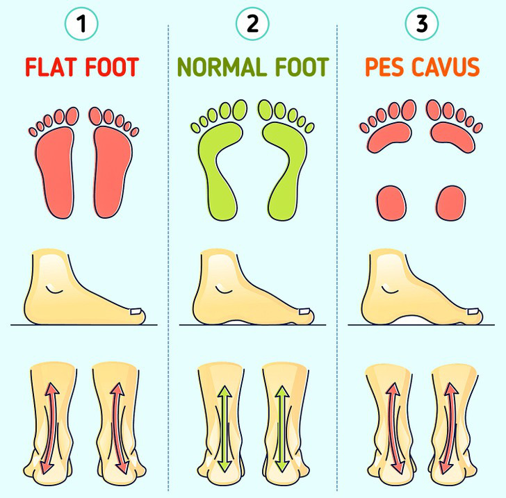 9 sai lầm mua giày 'tiền mất, tật mang' - Ảnh 3. 9 sai lầm mua giày 'tiền mất, tật mang' - Ảnh 3.
