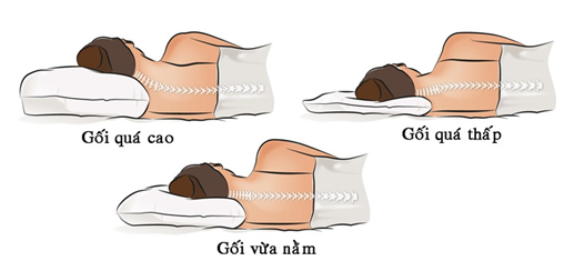 Ngoài cúi đầu xem điện thoại, thường xuyên làm 3 việc này cũng dễ bị thoái hóa đốt sống cổ - Ảnh 4. Ngoài cúi đầu xem điện thoại, thường xuyên làm 3 việc này cũng dễ bị thoái hóa đốt sống cổ - Ảnh 4.