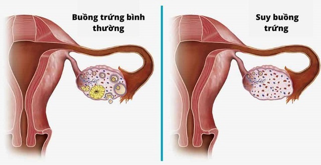 3 nhóm bệnh nguy hiểm phụ nữ U40 phải đối mặt, cần tăng cường 5 nhóm thực phẩm này để đối phó các triệu chứng tiền mãn kinh - Ảnh 2.