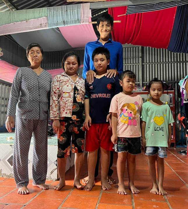 Ch&agrave;ng trai 22 tuổi ở C&agrave; Mau bỗng dưng cao đột biến hơn 2m - Ảnh 3.