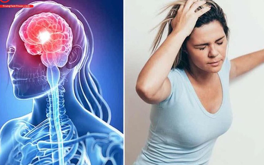 Cô gái 19 tuổi đột quỵ não sau cơn đau đầu đột ngột, chuyên gia khuyến cáo giới trẻ cần biết điều này để phòng bệnh cho chính mình