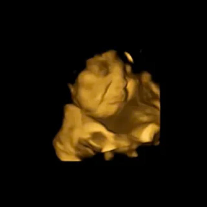 Bất ngờ về vẻ mặt của thai nhi trong bụng mẹ - Ảnh 2.