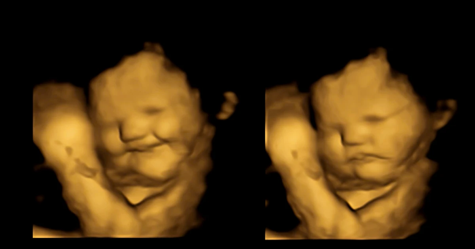 Bất ngờ về vẻ mặt của thai nhi trong bụng mẹ - Ảnh 1.