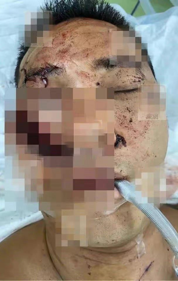 Diễn viên Hoàng Tuấn Phong bị chém 3 nhát vào mặt, bất tỉnh tại chỗ - Ảnh 1.