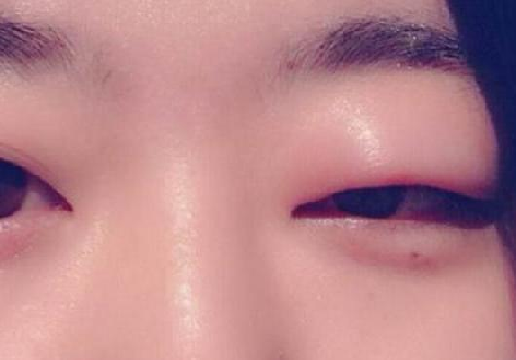 Nữ giới sau khi thức dậy v&agrave;o buổi s&aacute;ng nếu c&oacute; 3 biểu hiện n&agrave;y th&igrave; c&oacute; thể l&agrave; bạn đang b&eacute;o một c&aacute;ch &acirc;m thầm - Ảnh 2.